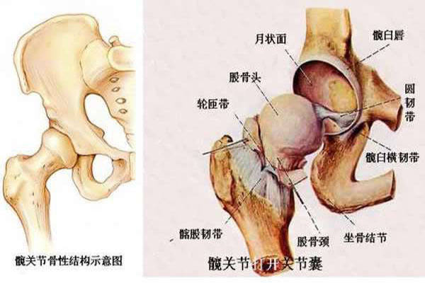 股骨头坏死对髋关节有什么影响