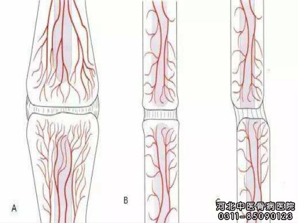 骨不连