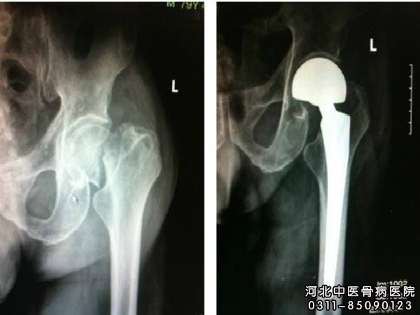 骨外伤