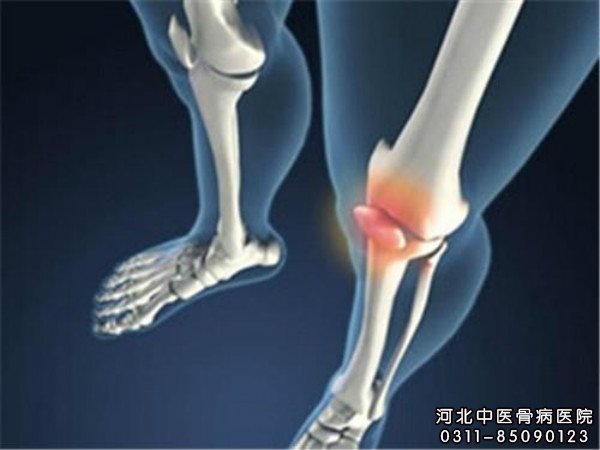 骨结核