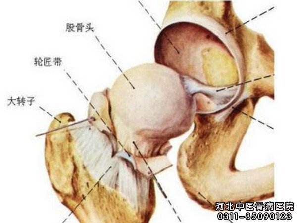 骨坏死