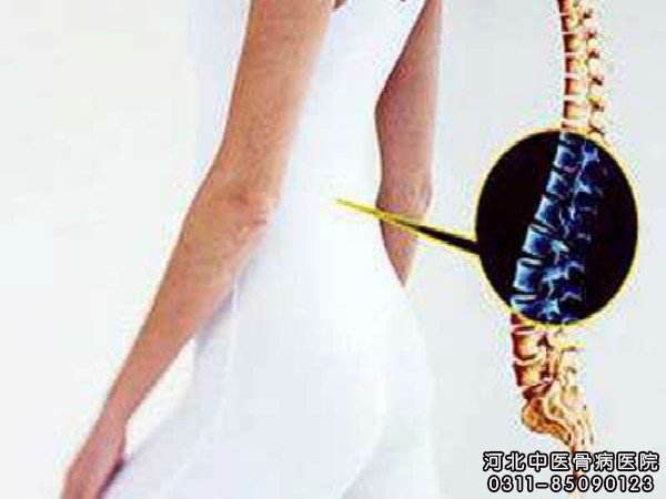 腰椎间盘突出