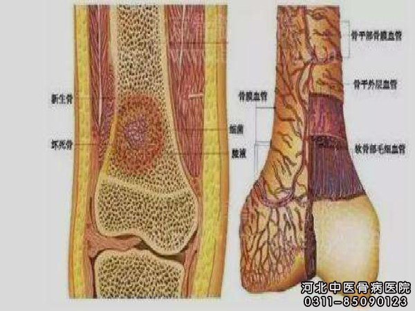 骨髓炎