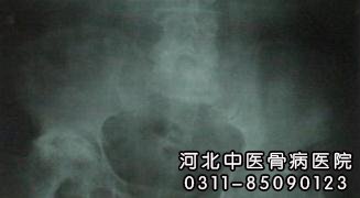骨外伤