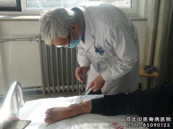 我院权力主任在为骨髓炎患者换药