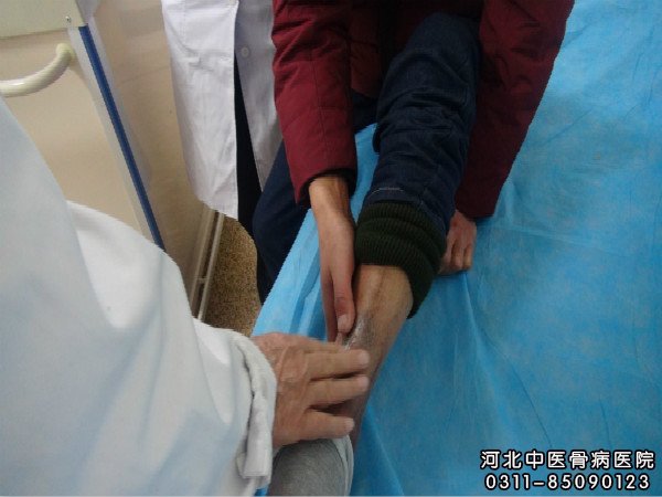 河北中医骨病医院骨髓炎住院患者