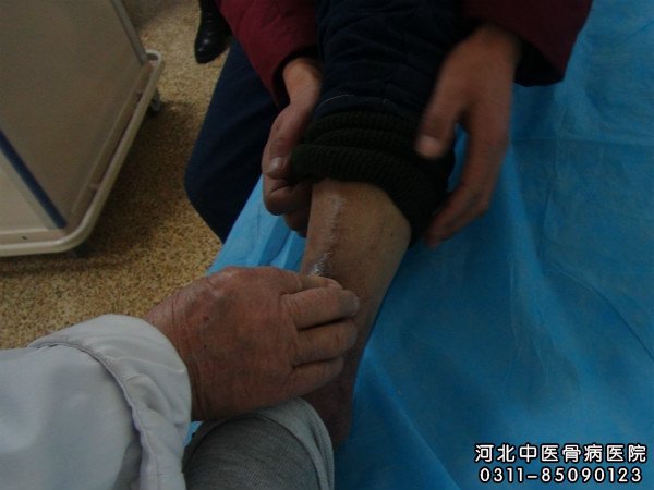 我院中医骨科大夫为患者查看伤口部位