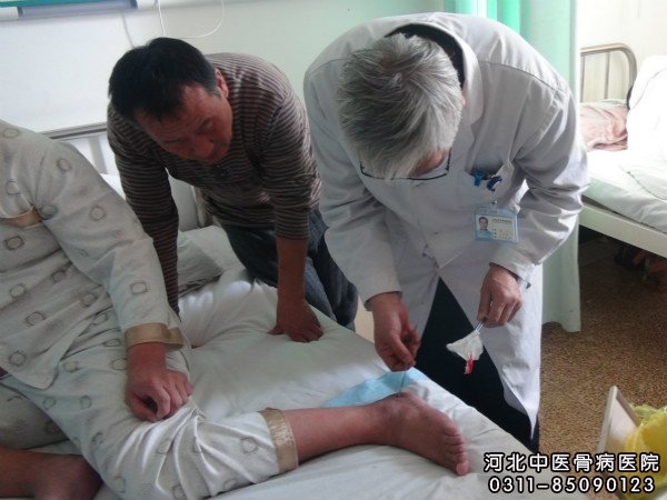 我院中医骨科权力主任在查看骨髓炎患者的窦道