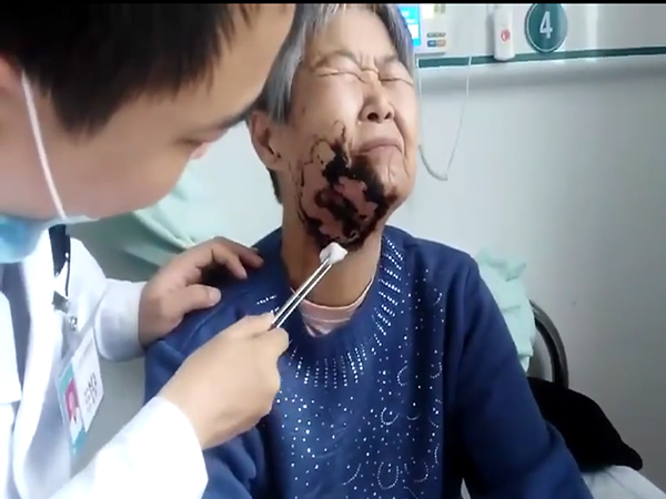 颌骨骨髓炎