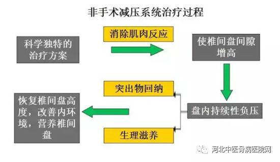 非手术减压系统